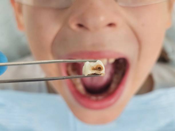 Best Emergency Orthodontic Services in Oblong, IL
