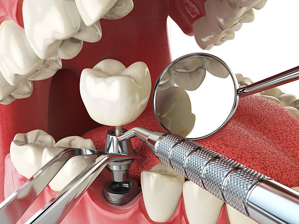 Best Same-Day Emergency Dental Services in Oblong, IL